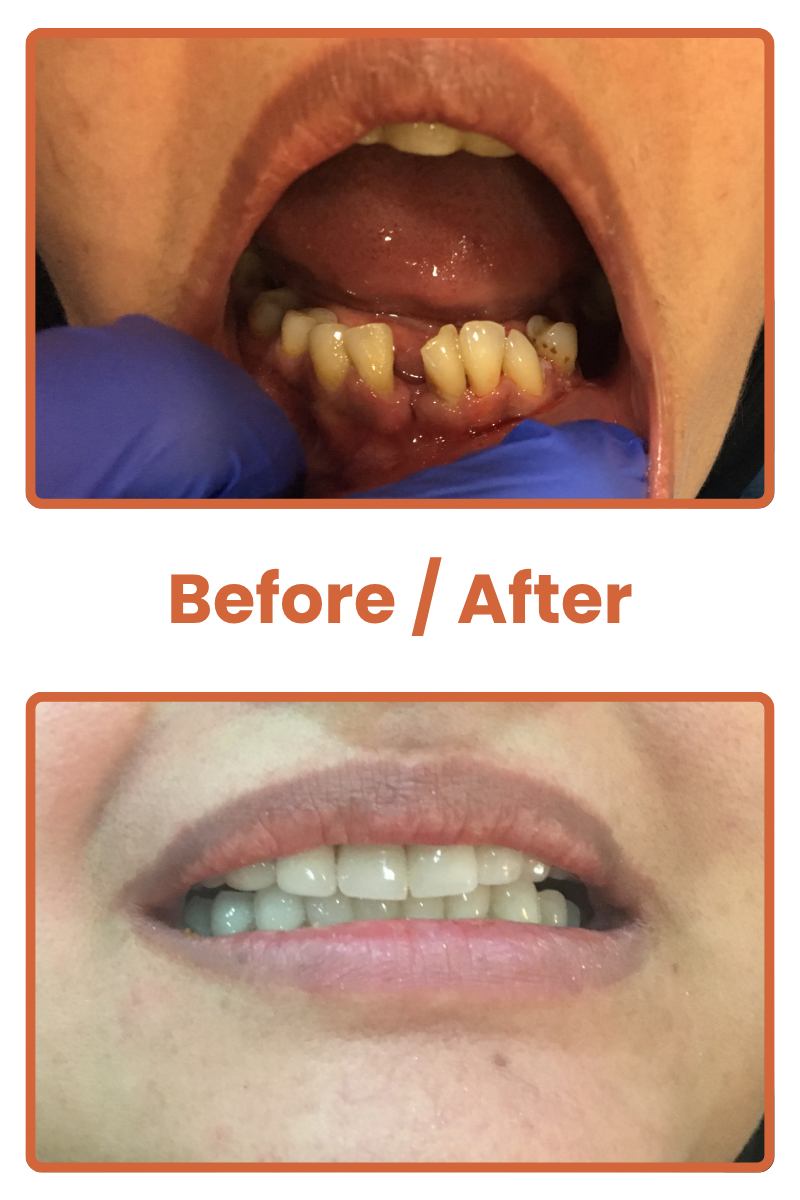 Best dentist near me in Safdarjung Enclave, affordable dental clinic near me in South Delhi, cosmetic dentist in Safdarjung Enclave Delhi, family dental clinic in South Delhi, emergency dentist near me in Safdarjung Enclave, teeth whitening dentist in South Delhi, pediatric dental clinic in Safdarjung Enclave, root canal specialist dentist in South Delhi, dental implant clinic in Safdarjung Enclave, orthodontist dentist near me in South Delhi.