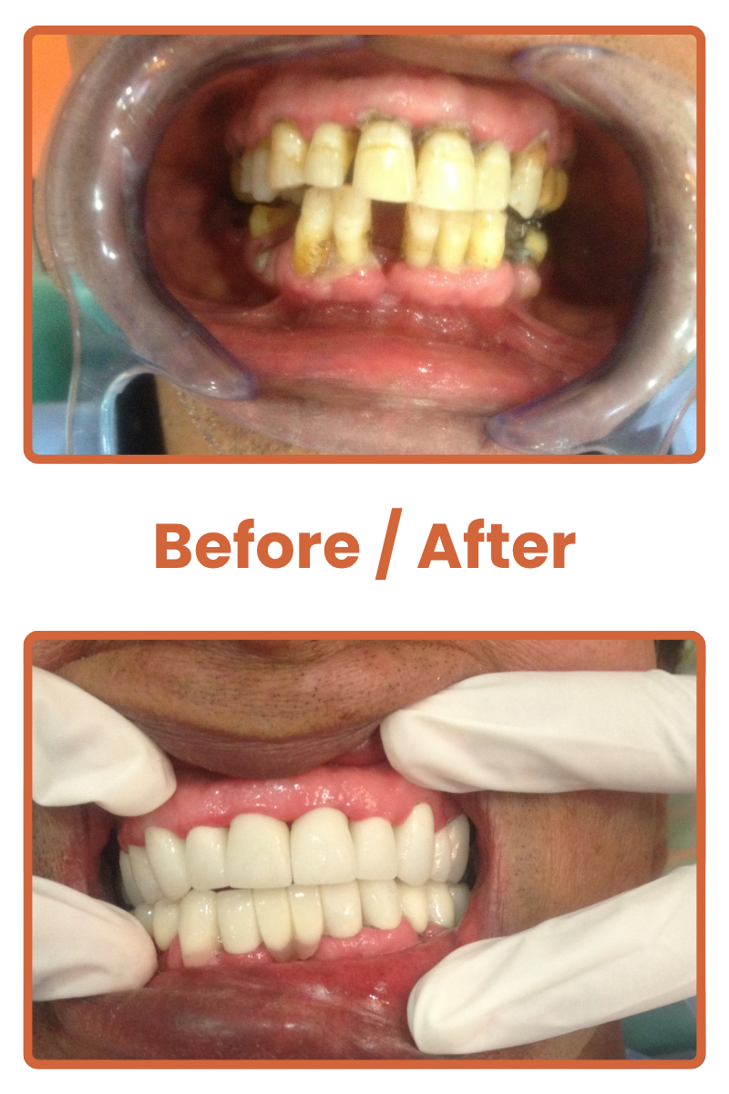 Best dentist near me in Safdarjung Enclave, affordable dental clinic near me in South Delhi, cosmetic dentist in Safdarjung Enclave Delhi, family dental clinic in South Delhi, emergency dentist near me in Safdarjung Enclave, teeth whitening dentist in South Delhi, pediatric dental clinic in Safdarjung Enclave, root canal specialist dentist in South Delhi, dental implant clinic in Safdarjung Enclave, orthodontist dentist near me in South Delhi.