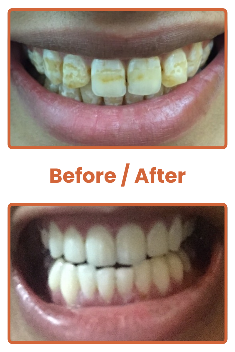 Best dentist near me in Safdarjung Enclave, affordable dental clinic near me in South Delhi, cosmetic dentist in Safdarjung Enclave Delhi, family dental clinic in South Delhi, emergency dentist near me in Safdarjung Enclave, teeth whitening dentist in South Delhi, pediatric dental clinic in Safdarjung Enclave, root canal specialist dentist in South Delhi, dental implant clinic in Safdarjung Enclave, orthodontist dentist near me in South Delhi.