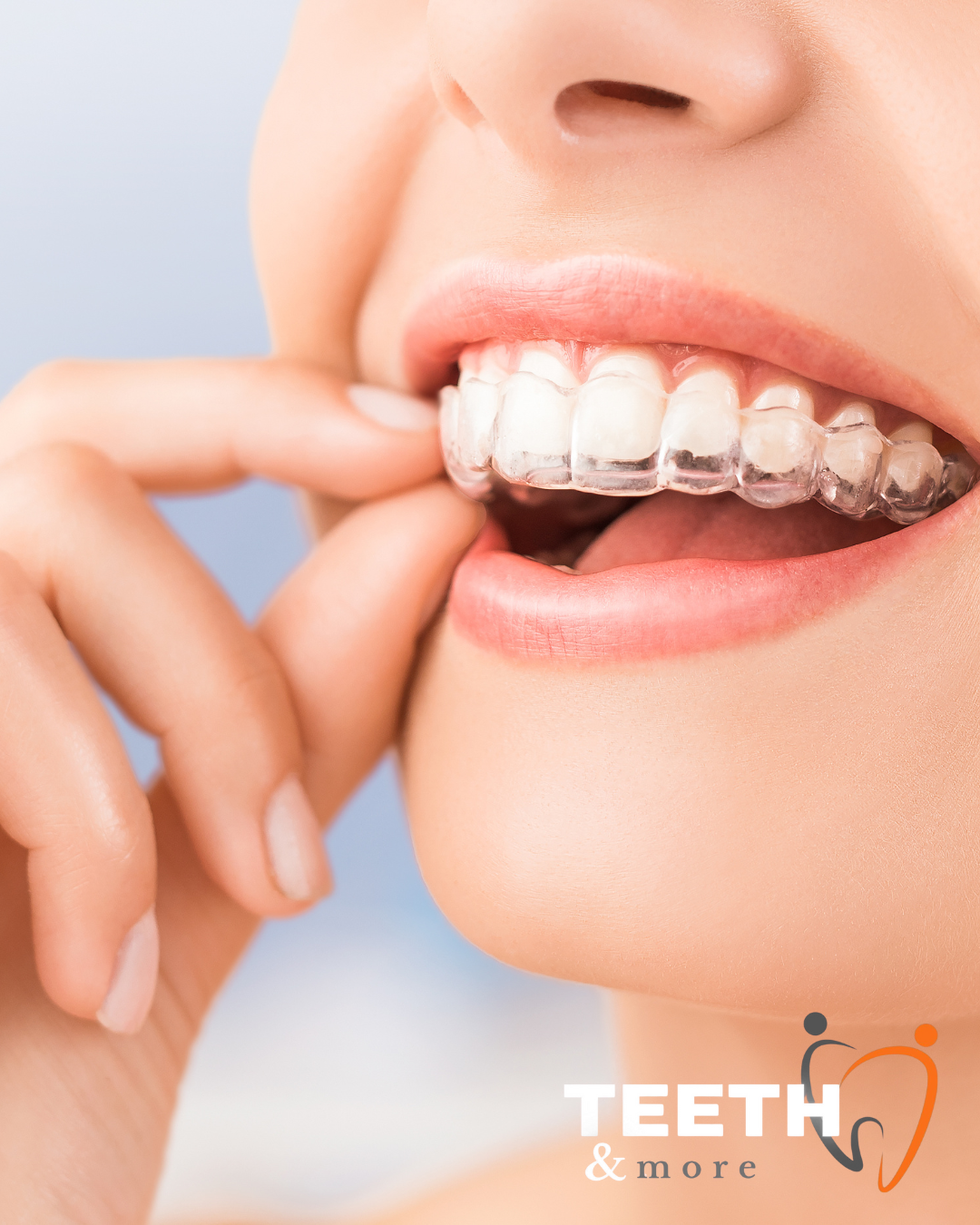 Facial Rejuvenation (29)