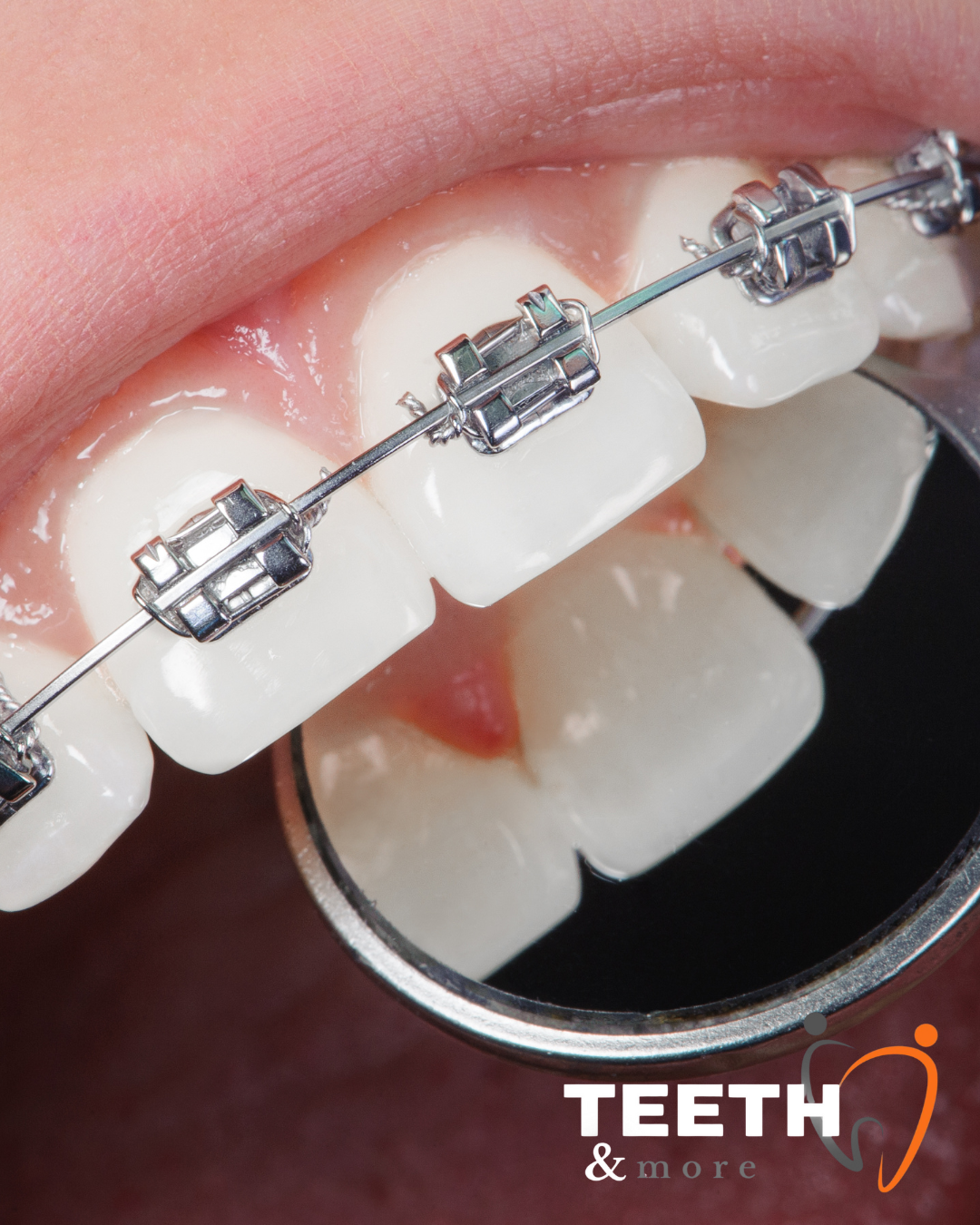 Facial Rejuvenation (34)