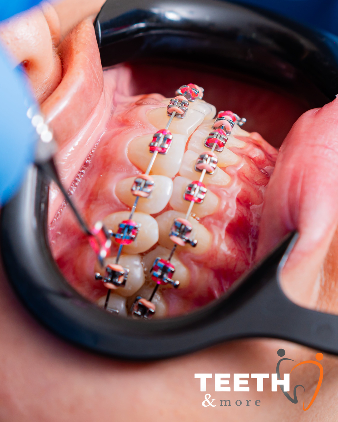 Facial Rejuvenation (37)