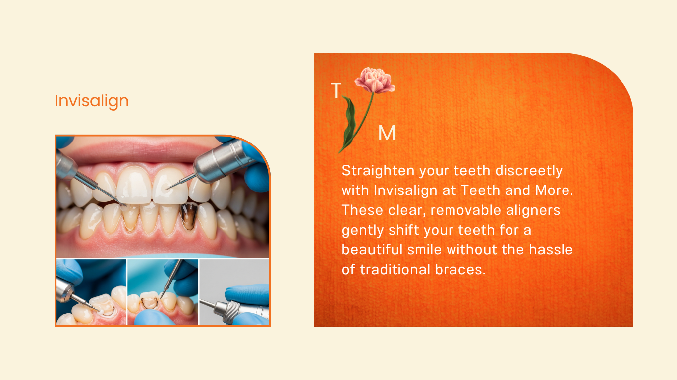 Braces Treatment in south Delhi , dentist in delhi , dental clinic in delhi