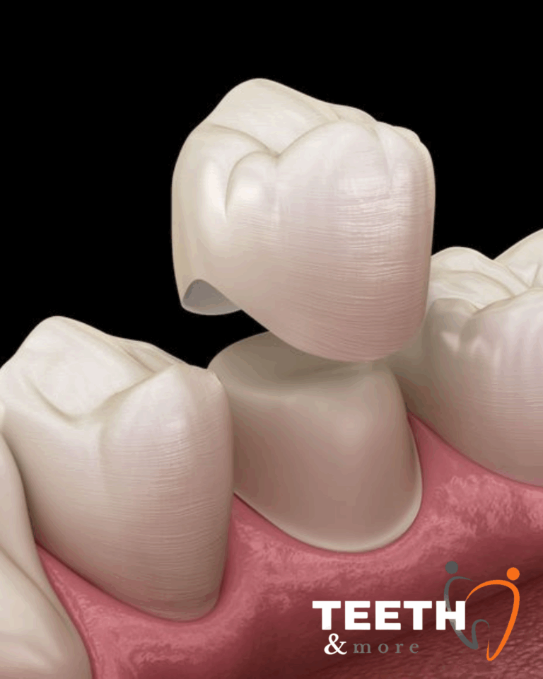 5 Important Reasons Why You Should Never Skip Your Regular Dental Checkups