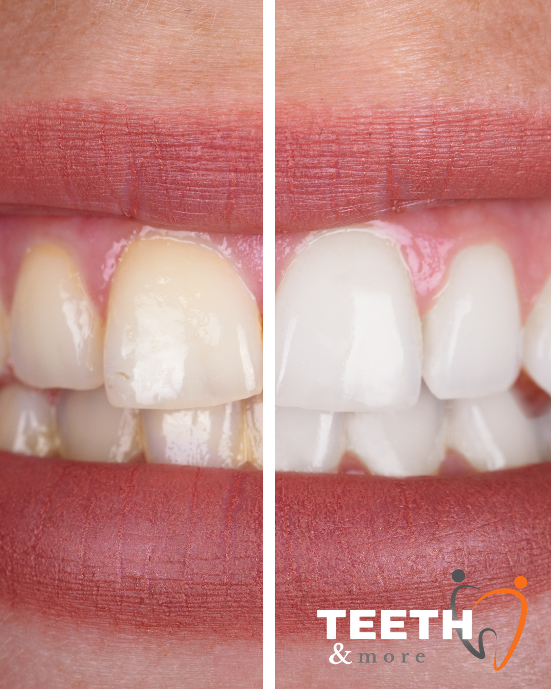 Untitled design (52)