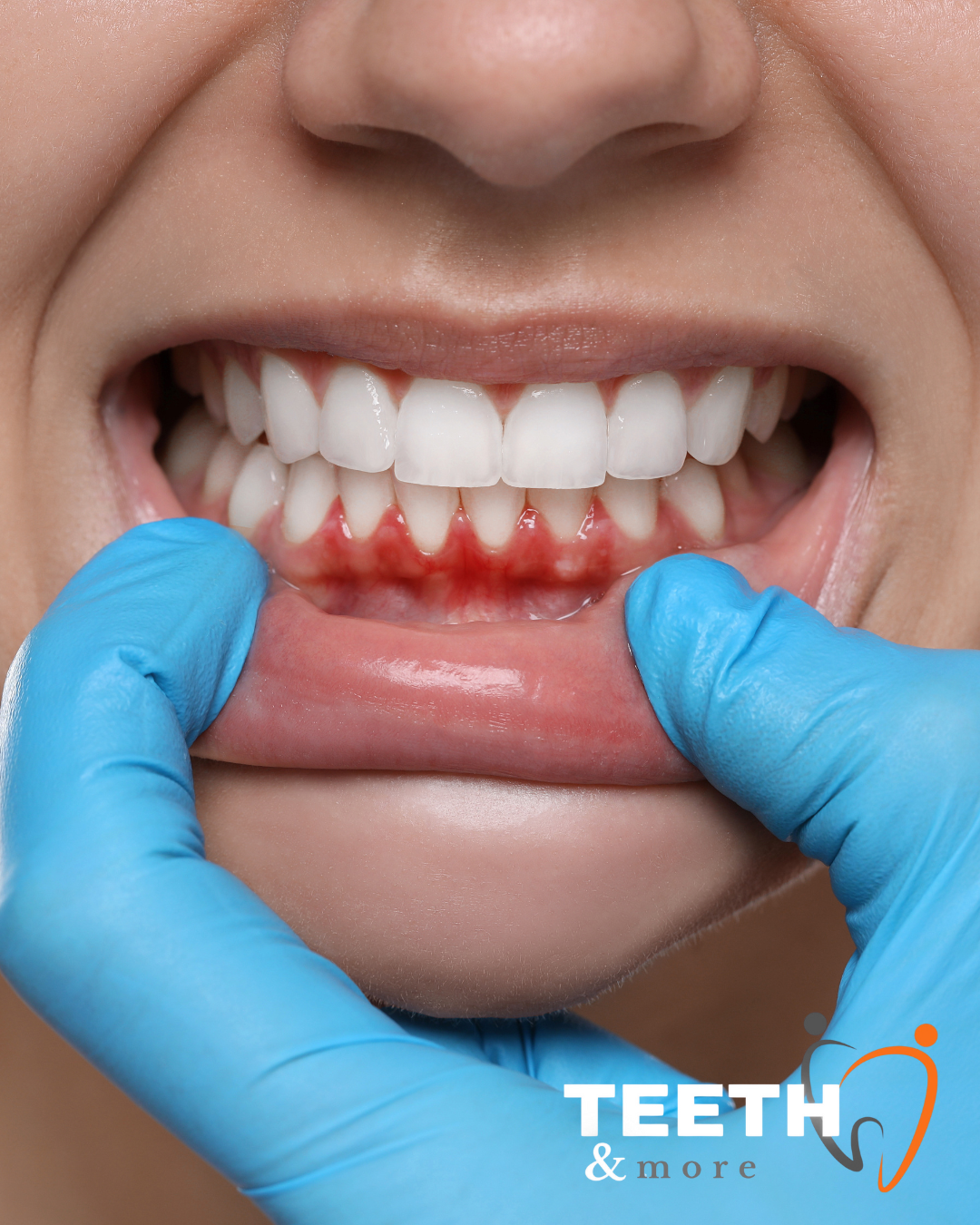 Untitled design (77)