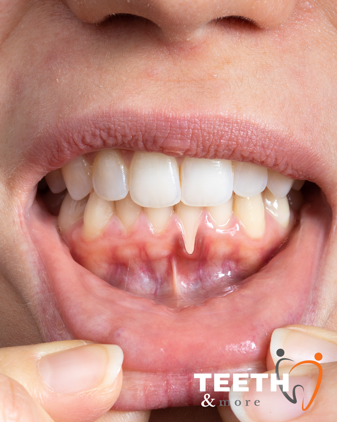 Untitled design (80)