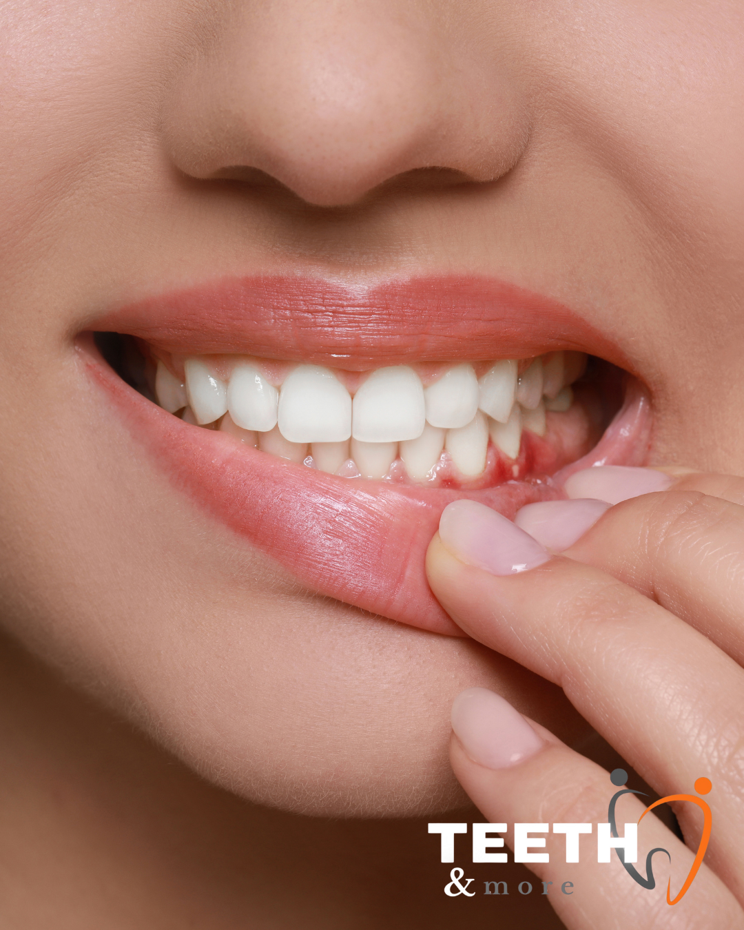 Untitled design (81)