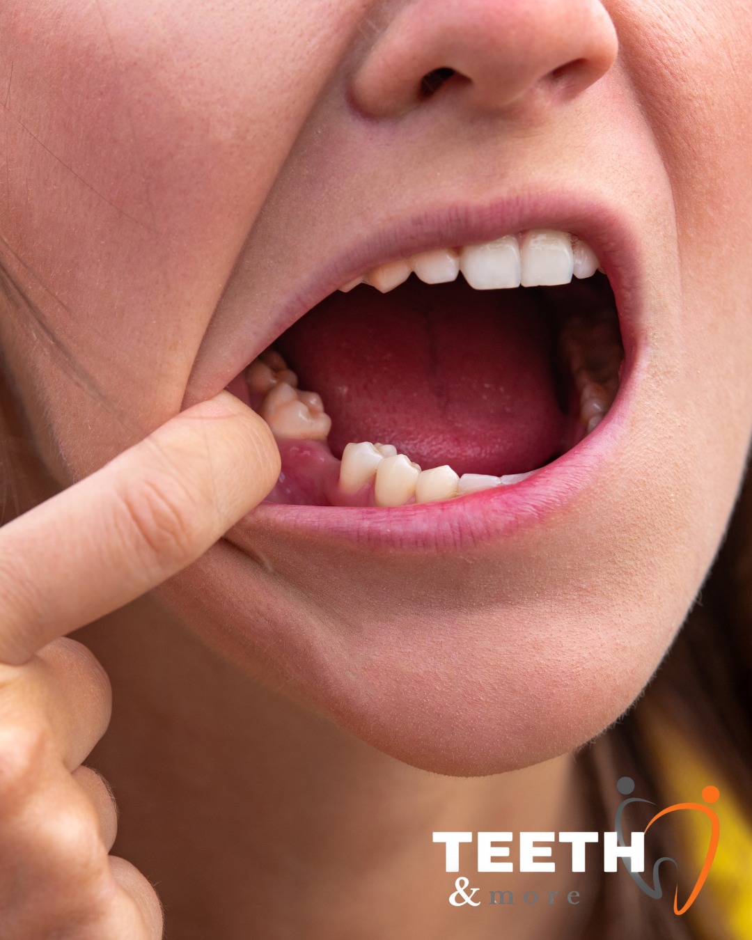 Untitled design (82)