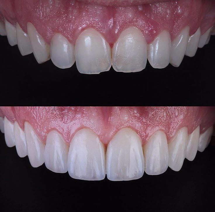 Top Dentist in Safdarjung Enclave – Teeth and More Dental Clinic