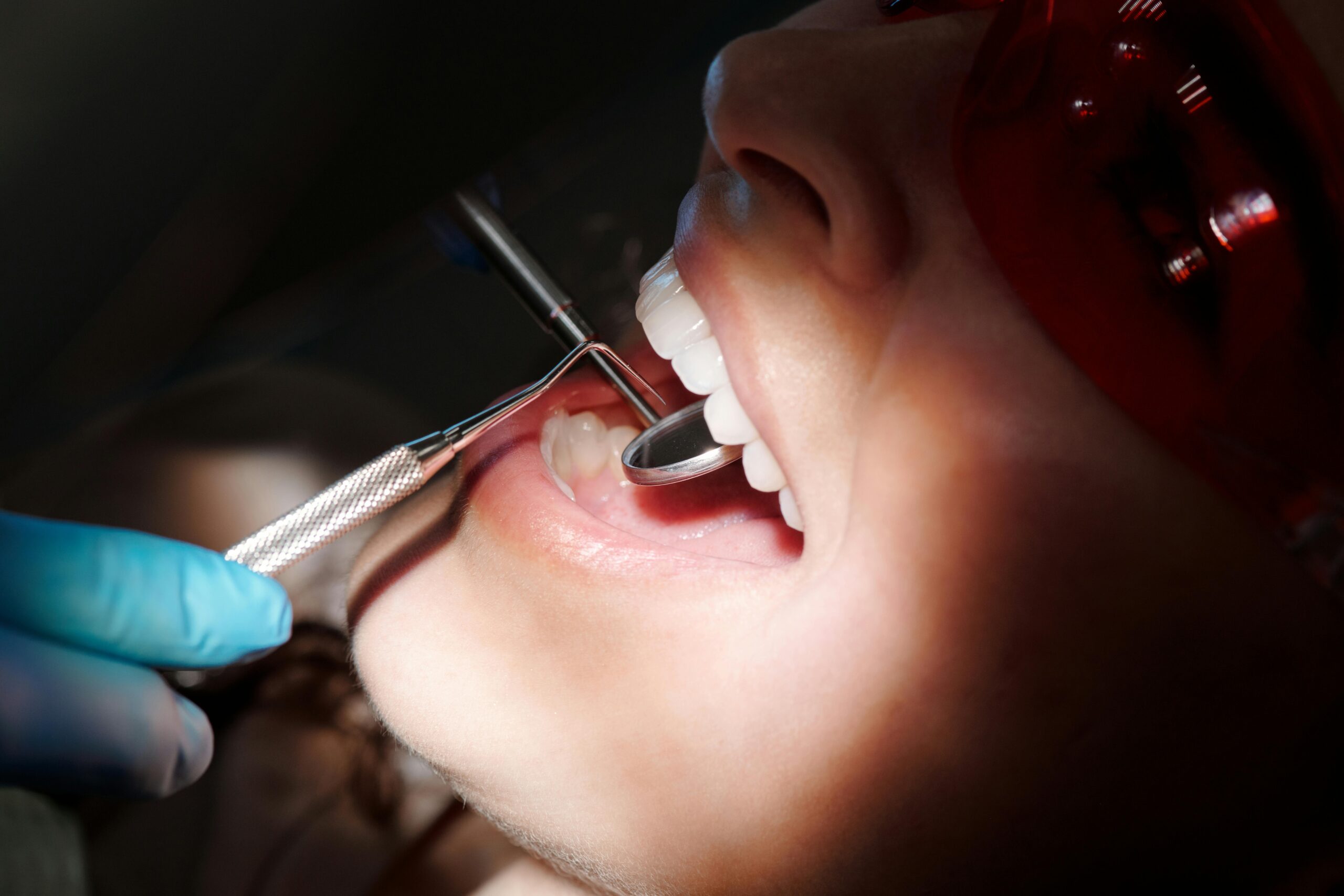 Dentist in Safdarjung Enclave Best dental clinic in Safdarjung Enclave Root canal specialist in South Delhi