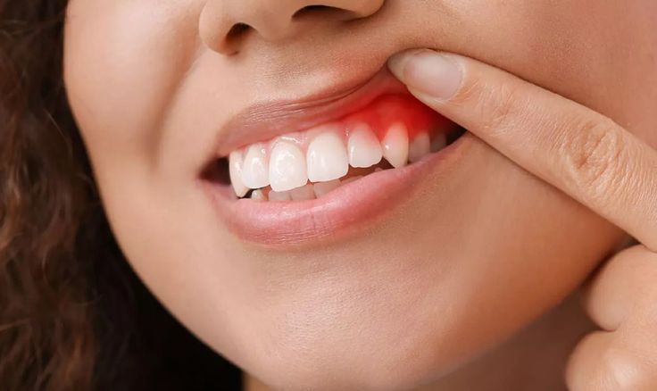 Dental hospital in Safdarjung Enclave providing family dental care
