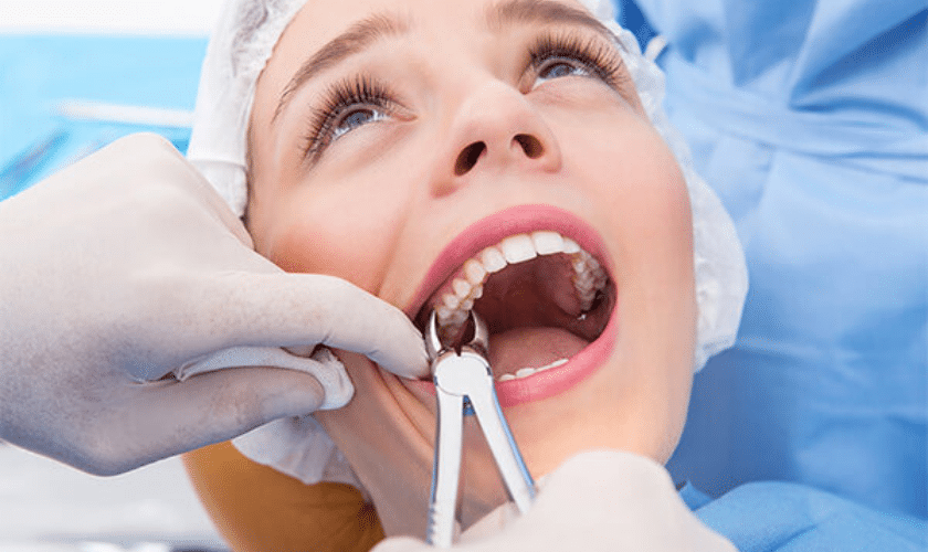 Tooth Extraction vs Root Canal